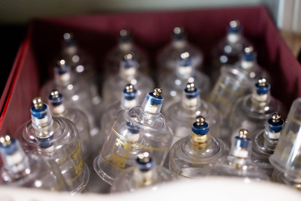 Ventouses de cupping